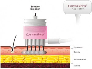 derma shine