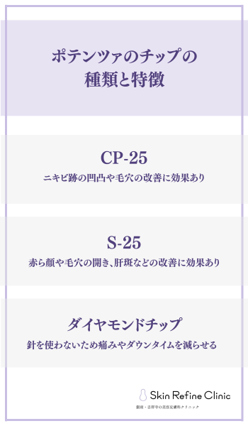 ポテンツァのチップの種類と特徴