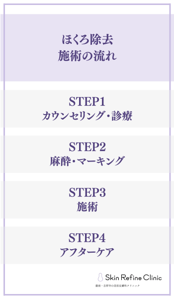 ほくろ除去の流れ