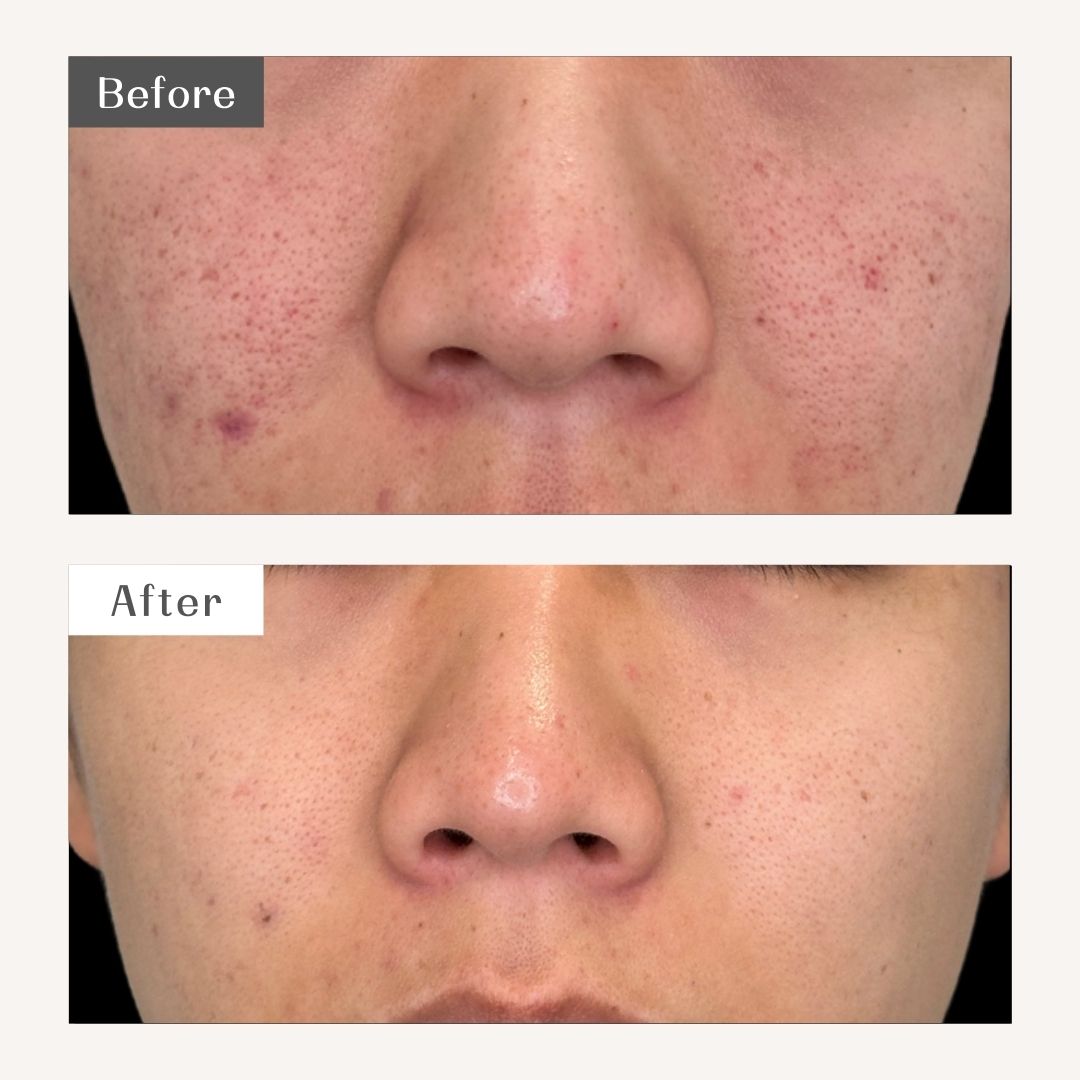 DAILY SKIN CLINIC After