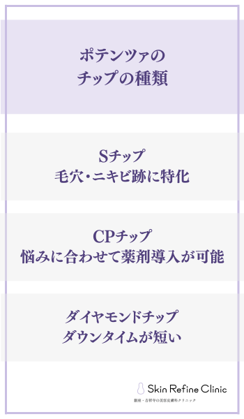 ポテンツァのチップの種類