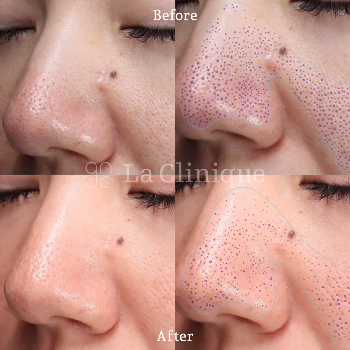 La Clinique 症例1