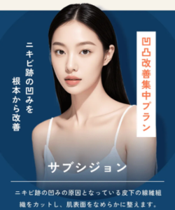 ライブリーサブシジョン