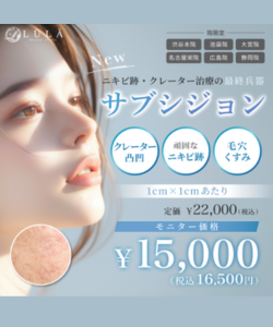 ルラサブシジョン