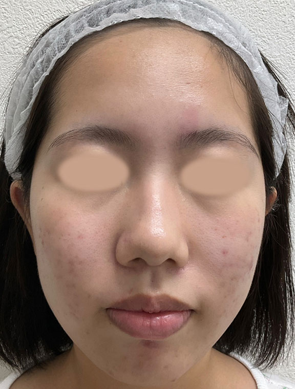 リゼクリニック After