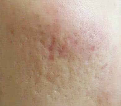 品川美容外科 Before