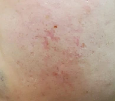 品川美容外科 Before