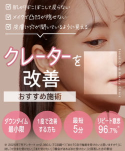 TCBサブシジョン