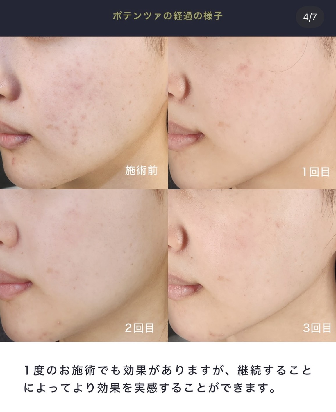 Tokyo Tensei Clinic 症例2