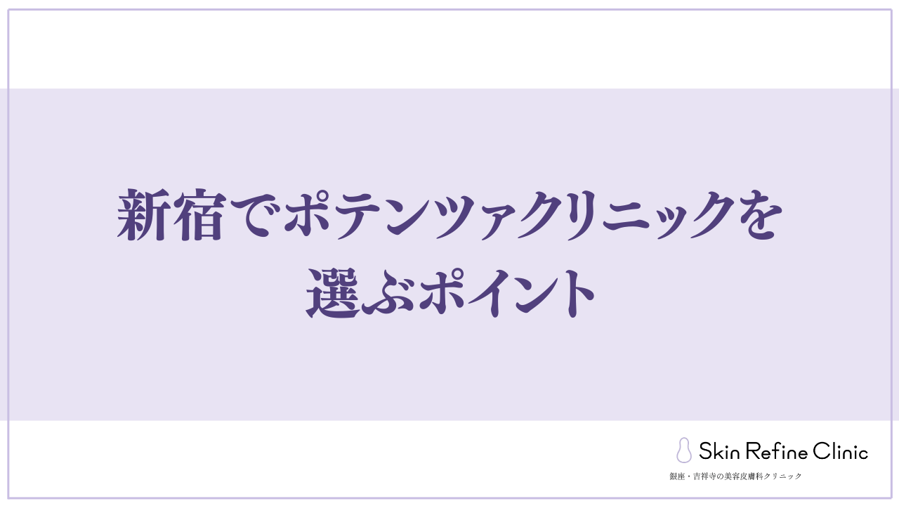 選ぶポイント