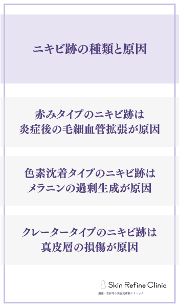 ニキビ跡の種類と原因