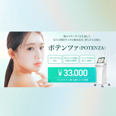 TCBポテンツァ