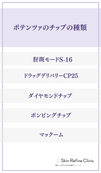 ポテンツァ名古屋チップの種類 見出し画像