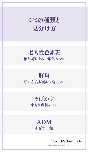 シミの種類と見分け方