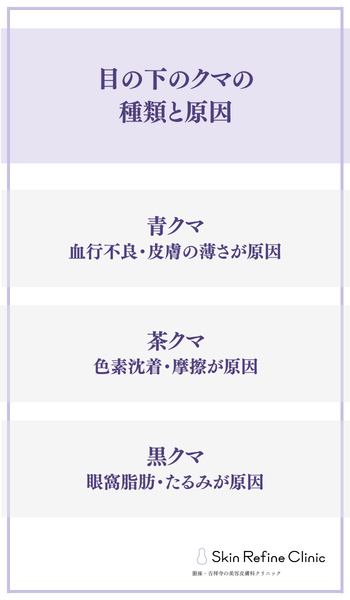 目の下のクマの種類と原因