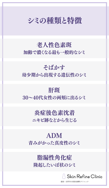 シミの種類と特徴