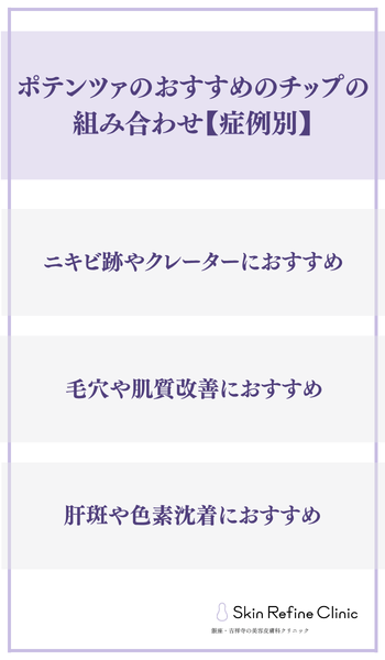 名古屋 ポテンツァ チップ
