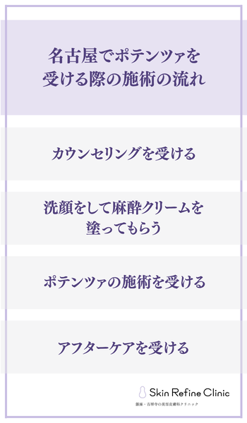 名古屋 ポテンツァ 流れ