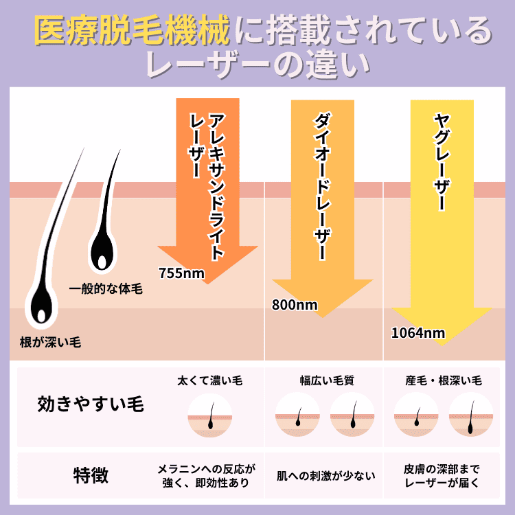 医療脱毛機械搭載のレーザーの違い