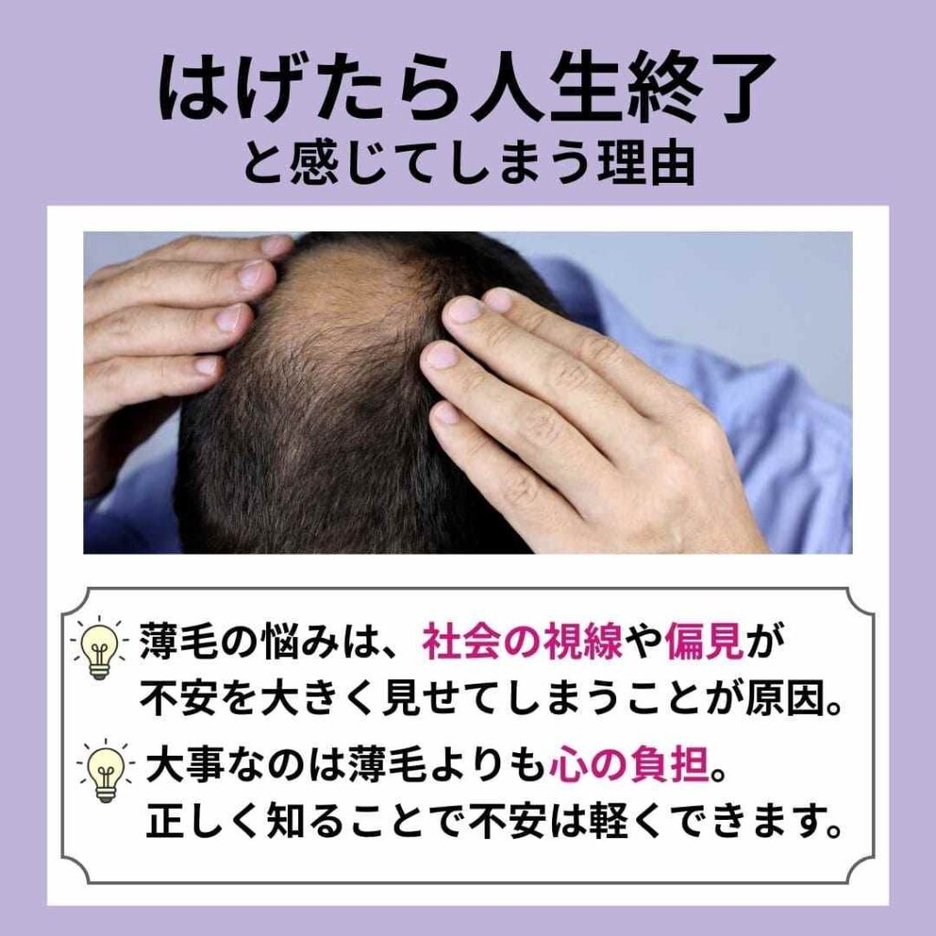 はげたら人生終了と感じてしまう理由
