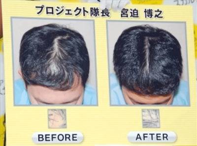 宮迫博之さんの薄毛画像