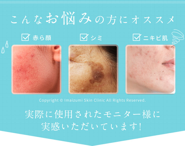 Jan Marini Skin Research スペシャルスキンケア NEW BEAUTY AWARD１５