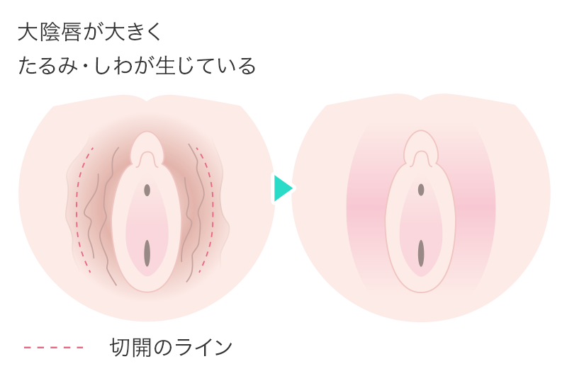 花井潮ブログ スキンリファインクリニック 花井潮ブログ スキンリファインクリニック
