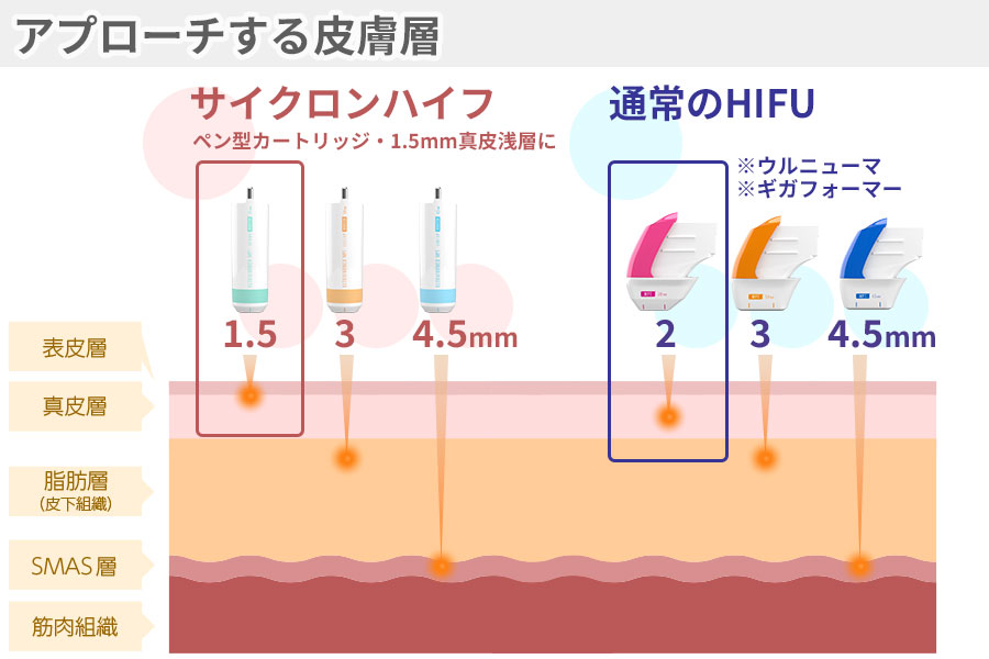 ハイフカートリッジ 1.5mm - 美容/健康